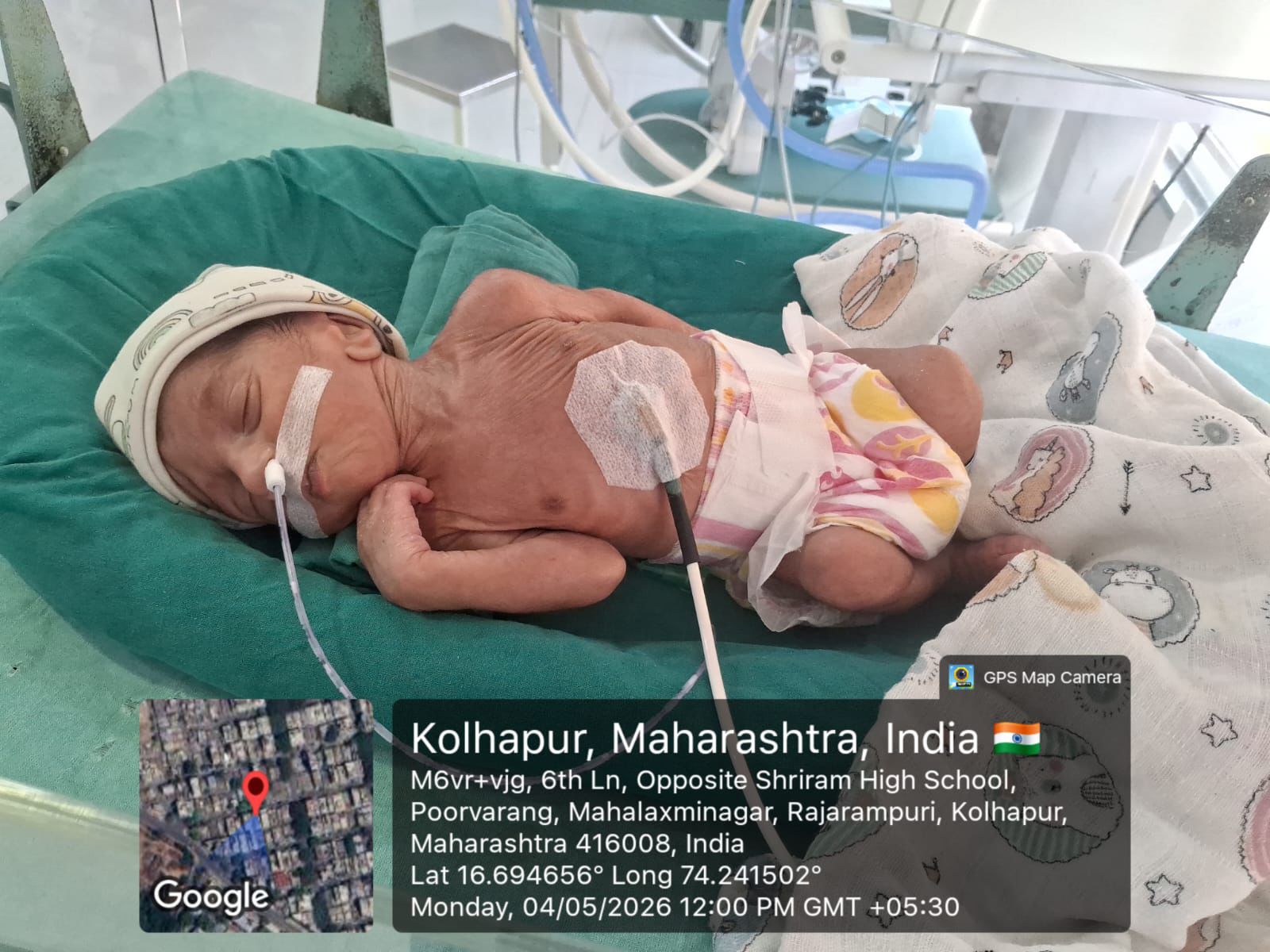 Urgent NICU Support for Baby