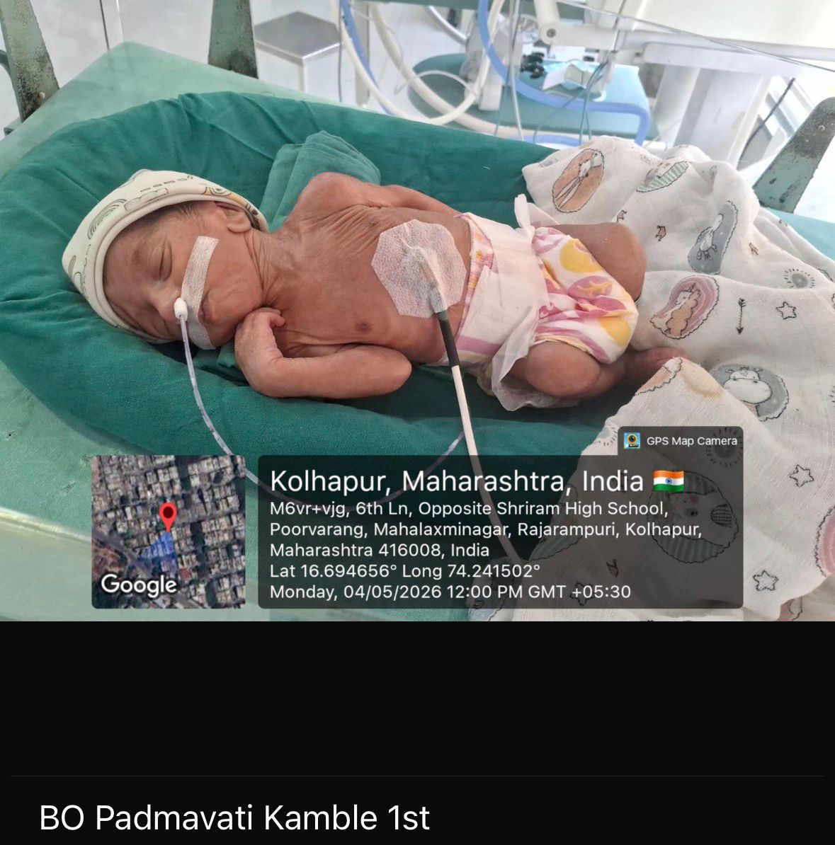 Urgent NICU Support for Baby