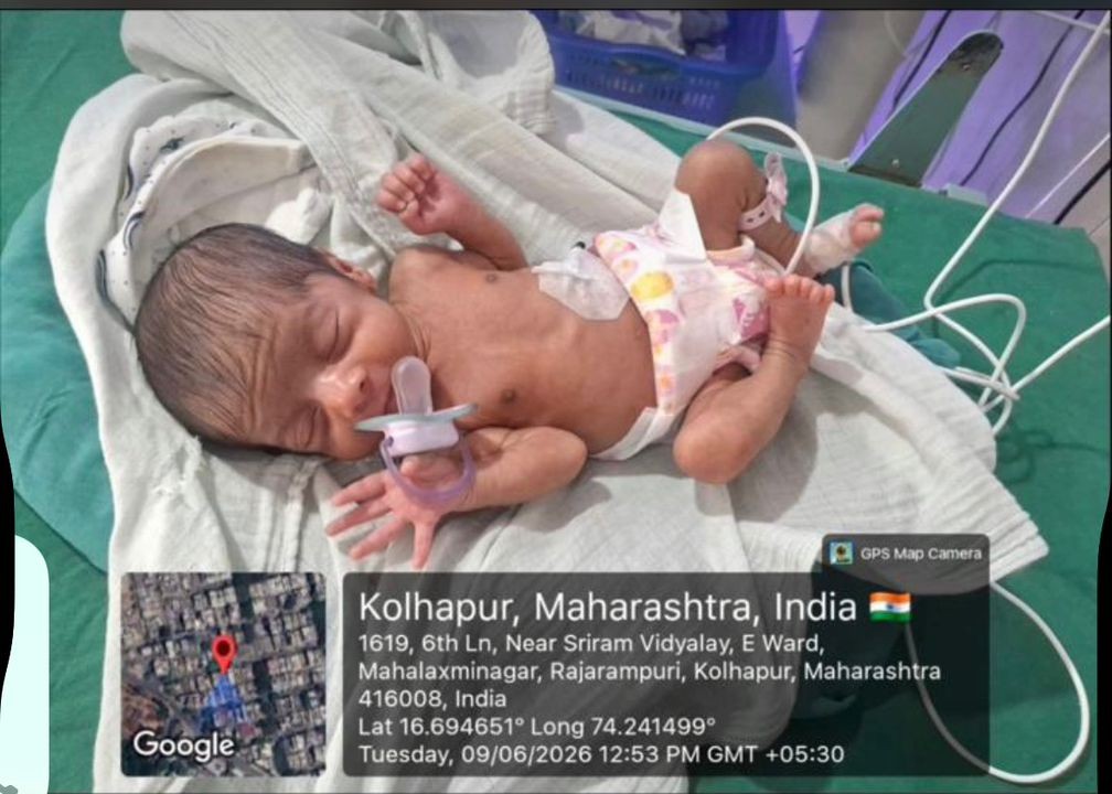 Urgent NICU Support for Baby Vaishnavi Kumar Lohar