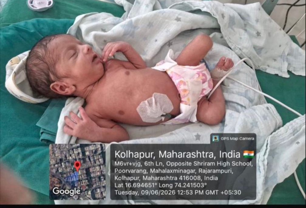 Urgent NICU Support for Baby Vaishnavi Kumar Lohar