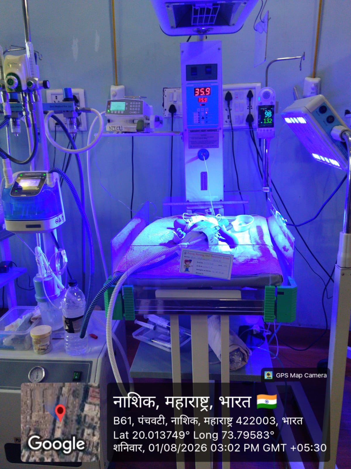 Help Save Newborn Baby More Vishvajit – Every Minute in NICU is a Fight for Life