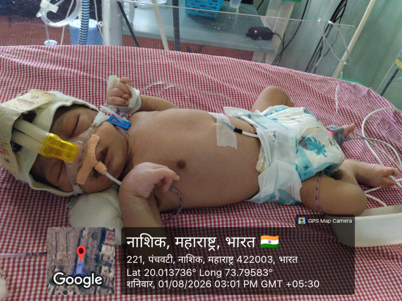 Help Save Newborn Baby More Vishvajit – Every Minute in NICU is a Fight for Life
