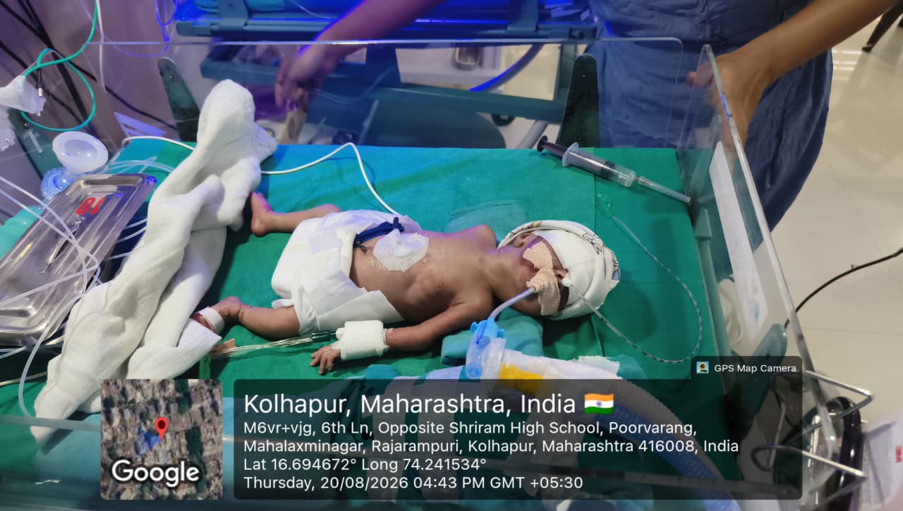 Help Baby Aishwarya Fight for Her Life