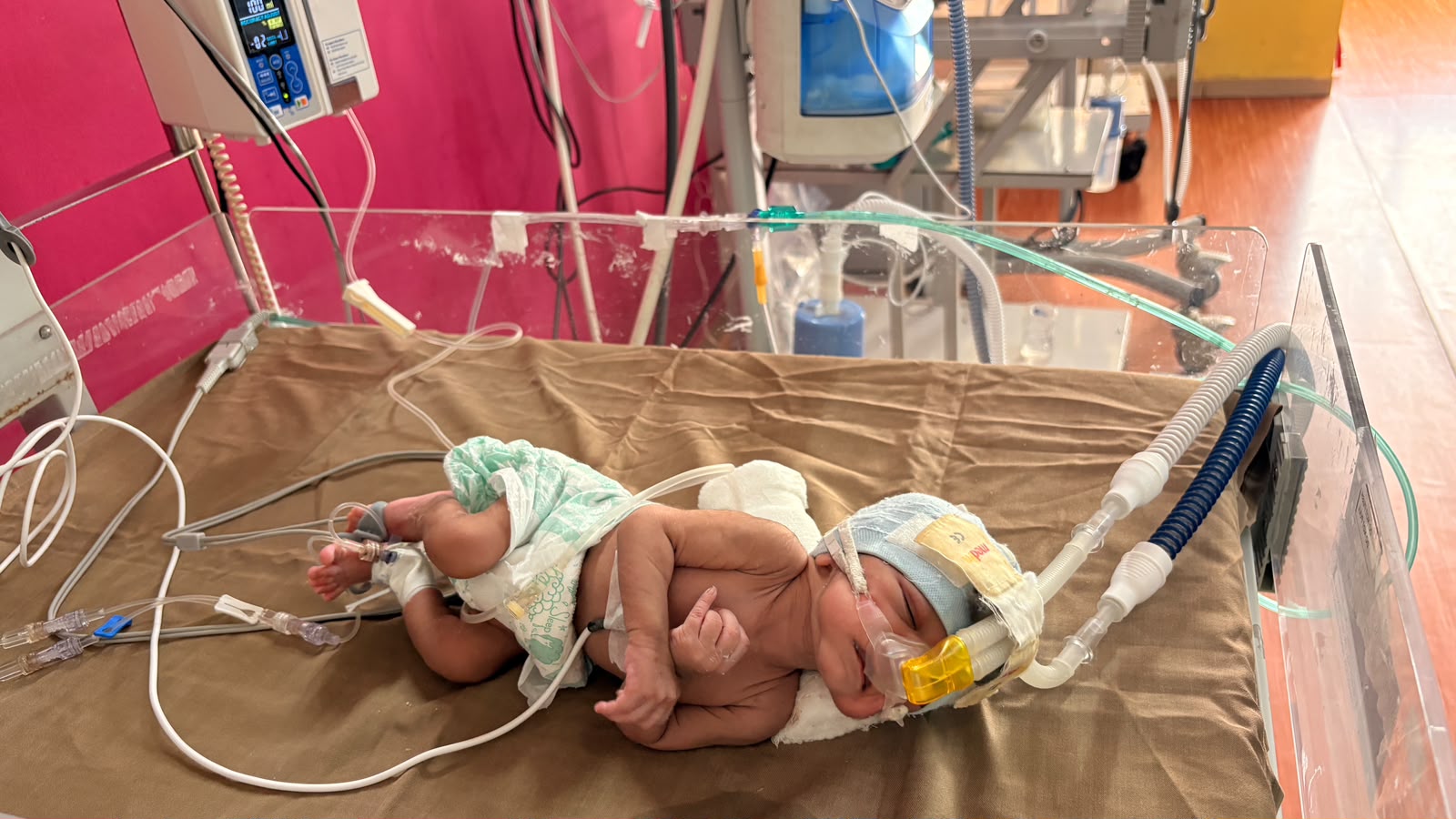 Help Baby Kalpana Fight for Her Life – Urgent NICU Support
